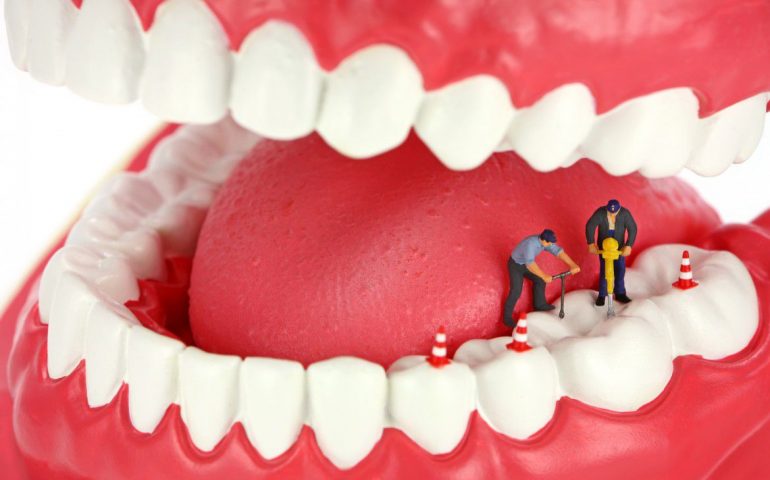 عصب کشی درمان ریشه دندان چیست