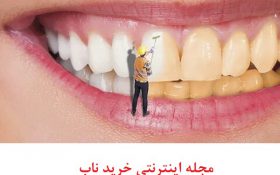انواع راه های جرم گیری دندان در خانه