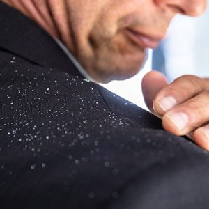 راه های از بین بردن شوره سر