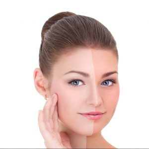 راه های درمان آفتاب سوختگی