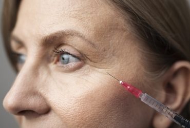 درمان سیاهی و چروک زیر چشم با نانوفت